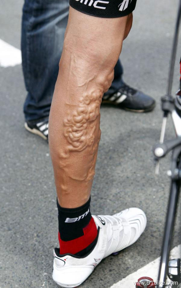 George-Hincapie-leg-veins.jpg